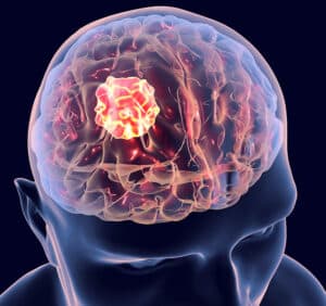 Brain Cancer Targeting