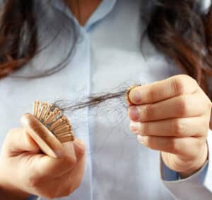 Hair Loss Targeting