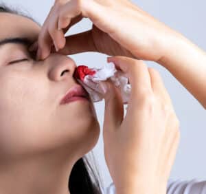 Hemophilia Targeting