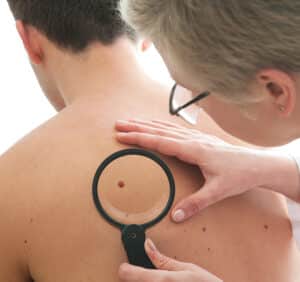 Melanoma Targeting