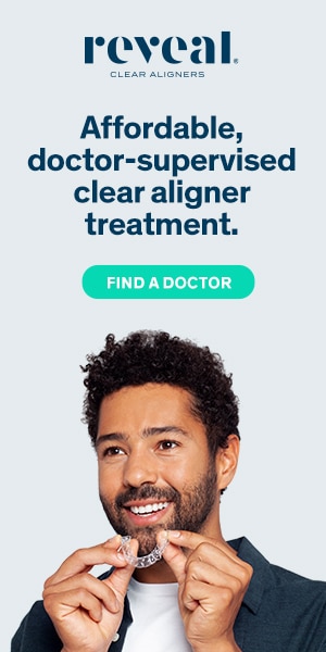 Dental Advertising - Reveal Clear Aligners - 300x600