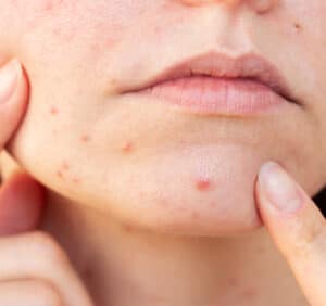 Dermatology Targeting