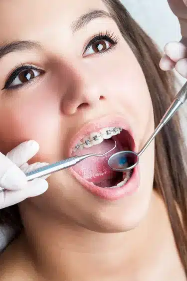 Orthodontists Targeting with Patient