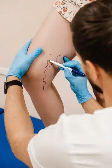 Phlebologists Targeting