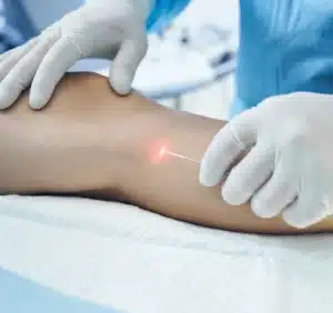 Phlebologists Targeting Phlebologists Targeting | Phlebology | Medical Practice | HCP Targeting | Health Care Professional Targeting