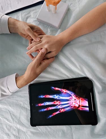 Rheumatologists Targeting - Hand